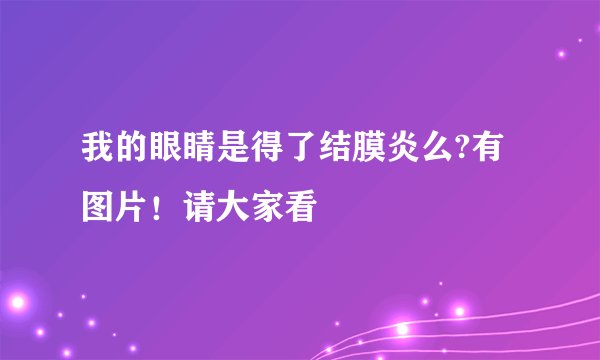 我的眼睛是得了结膜炎么?有图片！请大家看