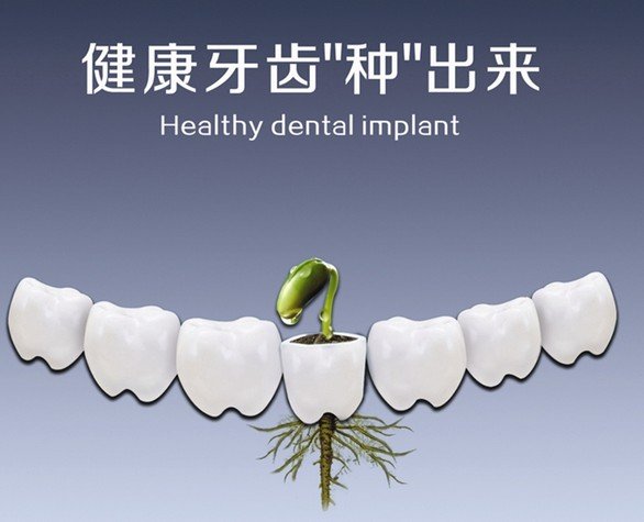 NOBEL种植牙系统的简介