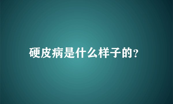 硬皮病是什么样子的？