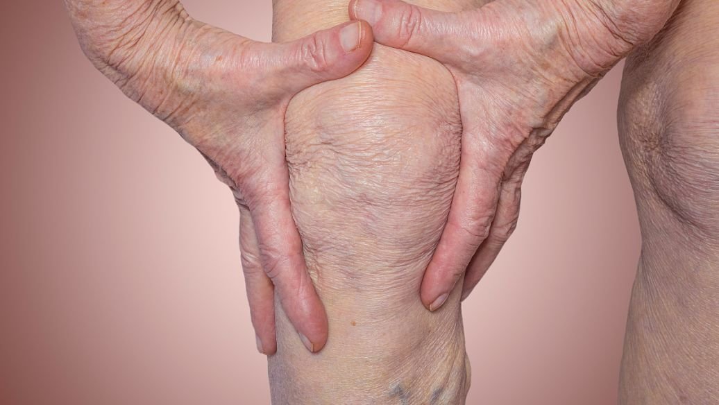 痛风是怎么引起来的？