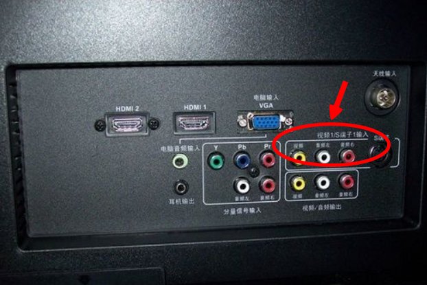 电信机顶盒怎么连接无线网络?