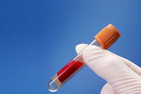 世界上真的存在比熊猫血还要稀有的“黄金血”吗？