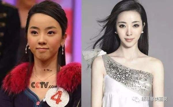 李思思是不是整容了？