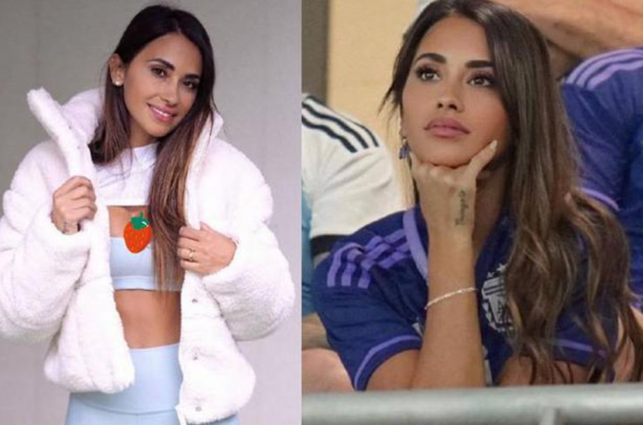 安东内拉是什么肤色