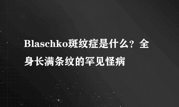 Blaschko斑纹症是什么？全身长满条纹的罕见怪病