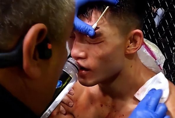 UFC：宋亚东遭对手TKO，无缘世界前五，此次比赛为何会失利