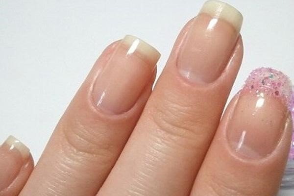 指甲凹凸不平,不要慌,原因一般有哪几个?