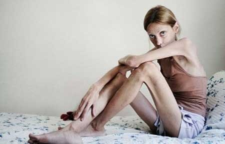 伊莎贝尔·卡罗的因厌食去世