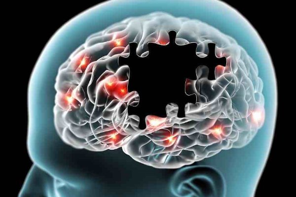 多巴胺的发音是怎样的？