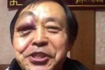 耗子为汁是什么东西