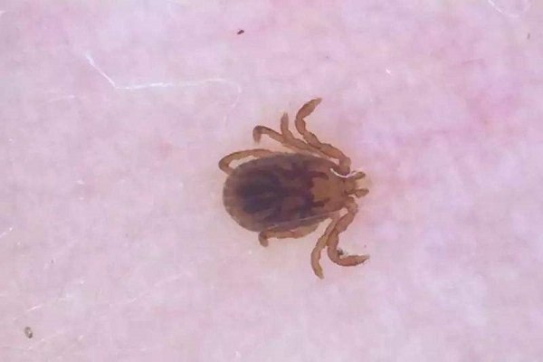 中国十大毒虫有哪些？