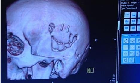 欧锦赛的守门员为什么可以头戴个绒线头套