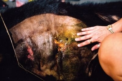 活体取胆的活体取胆