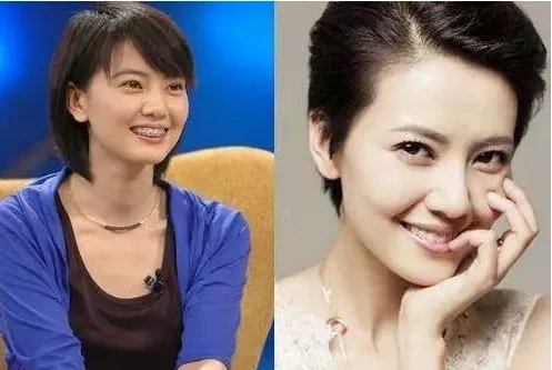 孙杨证明,牙齿正畸能让你变得更美!