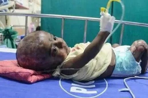 三月男婴身体无故自燃医生无解(图)