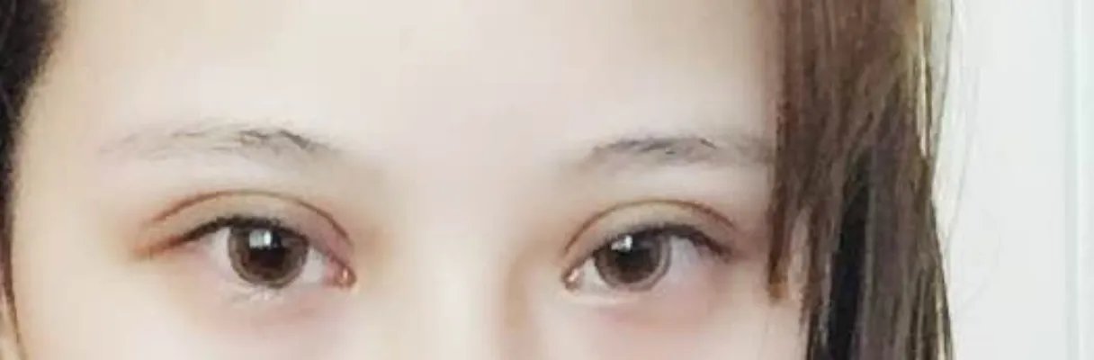 2021深圳福华医疗美容医院整形价目表(价格表)口碑怎么样_正规吗_地址