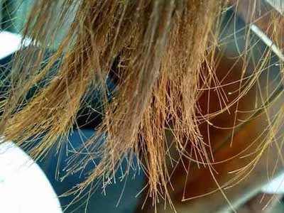 念珠状发症状图片