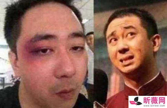 王自健被老婆打是真的吗 王自健被前妻家暴细节曝光惨不忍睹