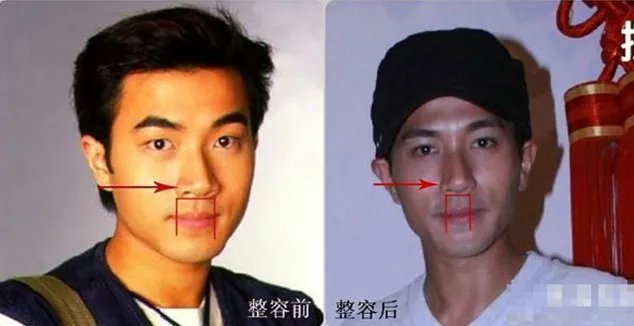 刘恺威整容前后照片对比 变得自信和英气