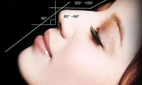 膨体隆鼻去什么医院