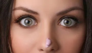 酒糟鼻激光能治好吗