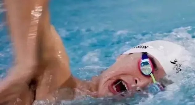 孙杨证明,牙齿正畸能让你变得更美!