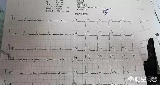 作为医生，你们见过的最幸运的病人有多幸运？