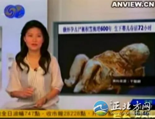 雪埋600年 怀孕古尸产活女婴