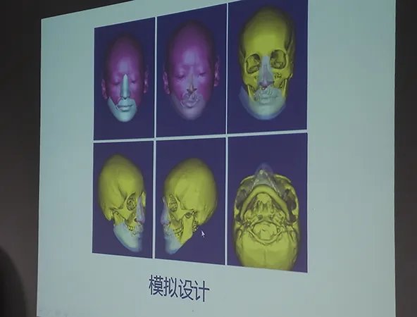 27岁女子换脸是怎么回事?