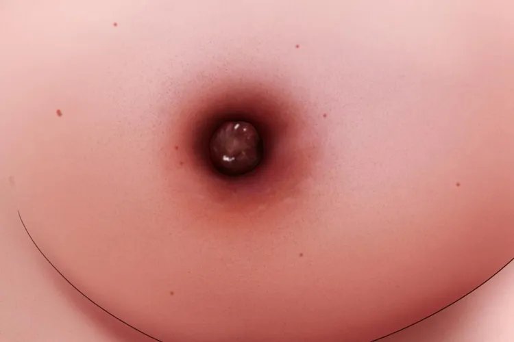 乳腺癌晚期真人图片