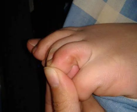 脚趾有这特征的祖先竟是希腊人 薄荷健康网(图)