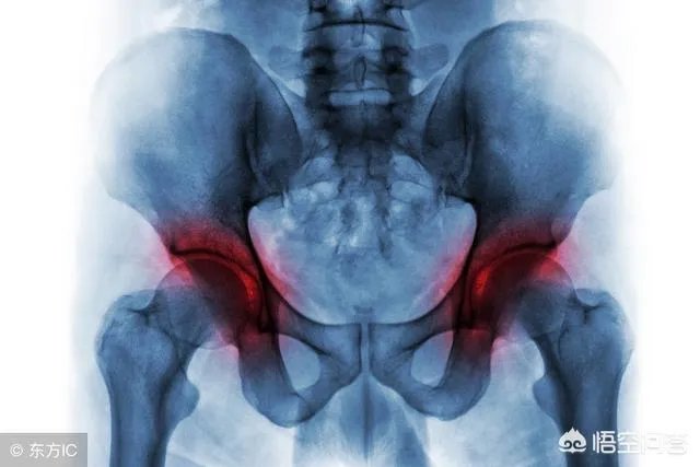 作为医生，你们见过的最幸运的病人有多幸运？