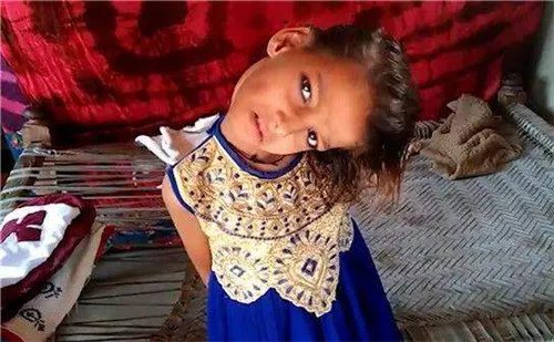 女孩头部无法竖立 被称为罪恶象征,村民害怕的瑟瑟发抖