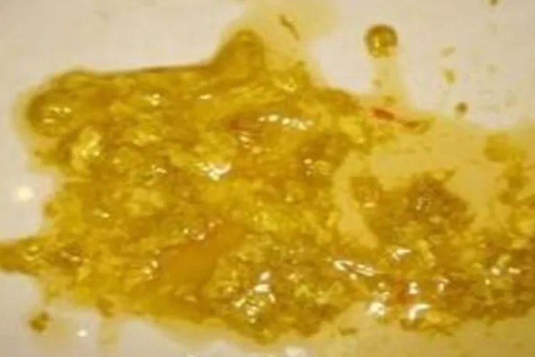 过敏的症状图片