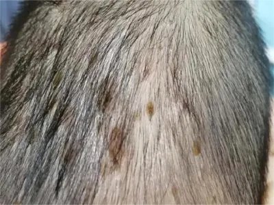 勒-雪病症状图片