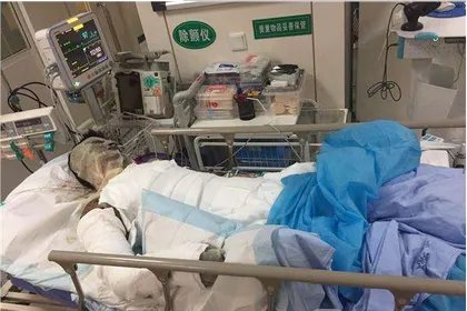 偷钓鱼触碰高压线是怎么回事？