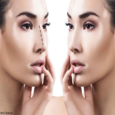 整形手术后伤口如何处理