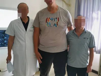 巨人症症状图片