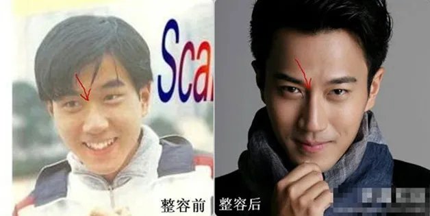 刘恺威整容前后照片对比 变得自信和英气
