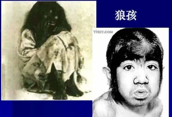 印度的狼孩卡玛拉:被狼哺育的女孩(在16岁时去世)