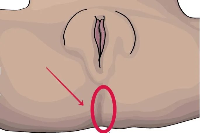 女孩的屁眼是什么样的