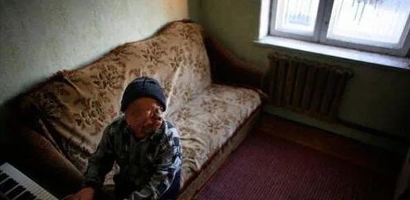 福岛核泄漏后变异女人：日本核辐射后的变异生物触目惊心
