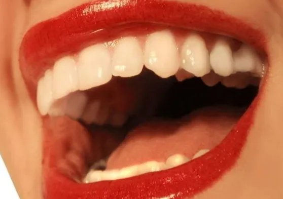 华山美容冠多少钱