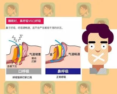 睡觉被亲妈用胶布封嘴?要知道,张嘴呼吸毁了可不仅是孩子颜值!