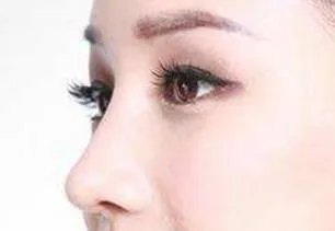 深圳整容缩小鼻翼多少钱