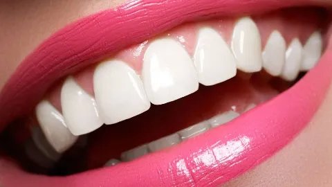 2021成都锦江极光口腔牙齿美白价格表(价目表)怎么样?