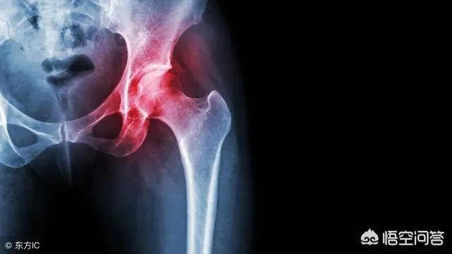 作为医生，你们见过的最幸运的病人有多幸运？