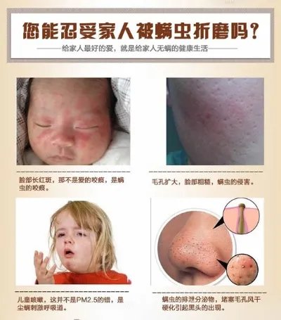 把枕头放进这里一夜后螨虫全死了(图)