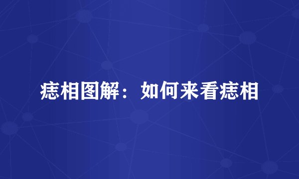痣相图解:如何来看痣相
