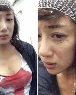 李依晓被咬事件始末以及被咬后的惨状图